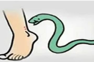 KORBA:-सर्पदंश से जिले में वृद्धा व बालिका की गई जान